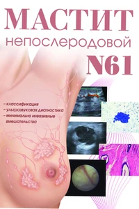 Мастит непослеродовой N61