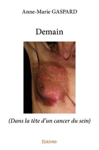 Anne-marie Gaspard - Demain - (Dans la tête d'un cancer du sein).