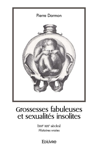 Grossesses fabuleuses et sexualités insolites (xvie xixe siècles). Histoires vraies