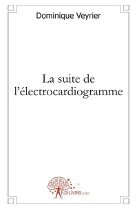 Dominique Veyrier - La suite de l'électrocardiogramme.