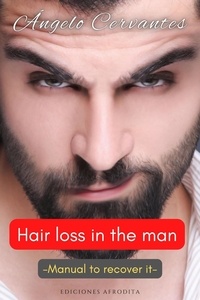  Ángelo Cervantes - Hair Loss in the Man.
