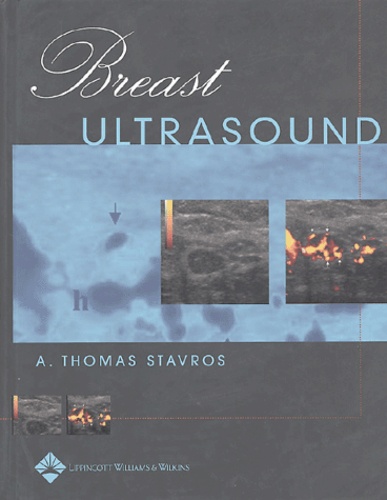 A-Thomas Stavros - Breast Ultrasound.