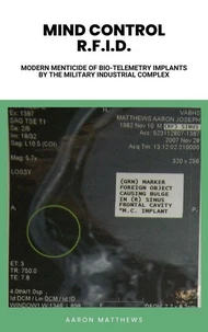 Mind Control R.F.I.D. Modern Menticide of Bio-Telemetry Implants by the Military Industrial Complex