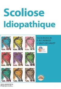 Scoliose idiopathique