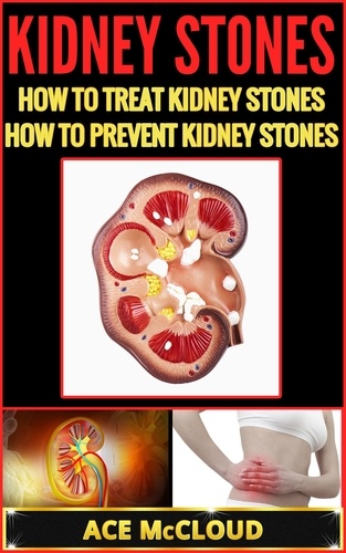 Ace McCloud - Kidney Stones: How To Treat Kidney Stones: How To Prevent Kidney Stones.