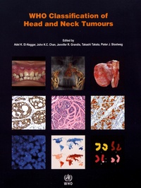 Adel K. El-Naggar et John K. C. Chan - WHO Classification of Head and Neck Tumours.