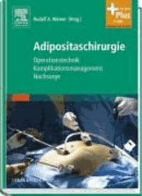 Adipositaschirurgie - Operationstechnik - Komplikationsmanagement - Nachsorge.