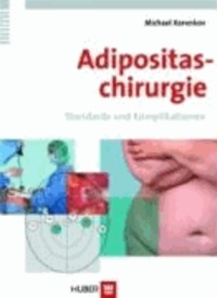 Adipositaschirurgie - Verfahren, Varianten und Komplikationen.