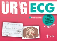 URG' ECG