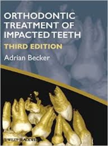 Adrian Becker - Orthodontic Treatment of Impacted Teeth.