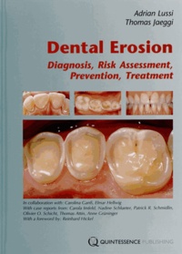 Adrian Lussi et Thomas Jaeggi - Dental Erosion - Diagnosis, Risk Assessment, Prevention, Treatment.