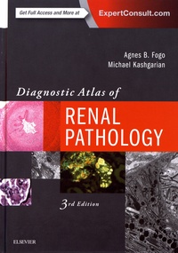 Diagnostic Atlas of Renal Pathology.pdf