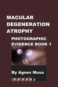 Macular Degeneration Atrophy, Photographic Evidence Book 1