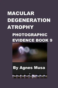 Macular Degeneration Atrophy, Photographic Evidence Book 9