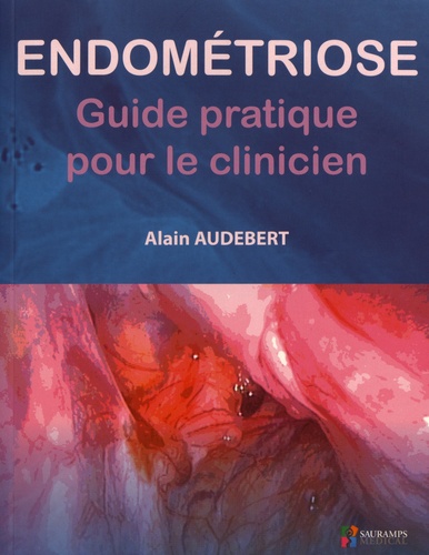 Endométriose. Guide pratique pour le clinicien