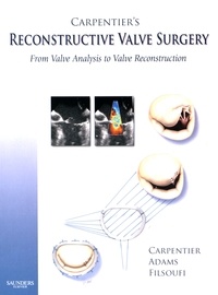 Alain Carpentier et David H. Adams - Carpentier's Reconstructive Valve Surgery - From valve analysis to valve reconstruction.