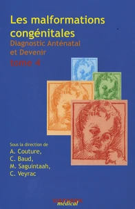 Les malformations congénitales
