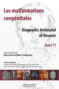 Les malformations congénitales