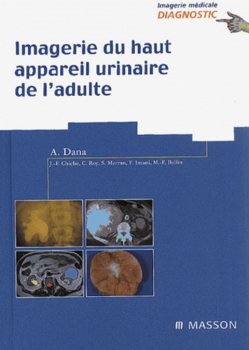 Alain Dana et  Collectif - Imagerie Du Haut Appareil Urinaire De L'Adulte.