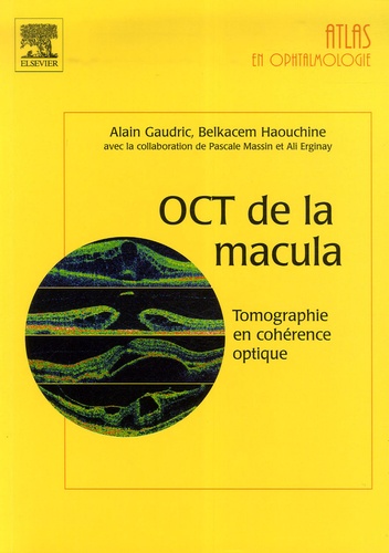 Alain Gaudric et Belkacem Haouchine - OCT de la macula.