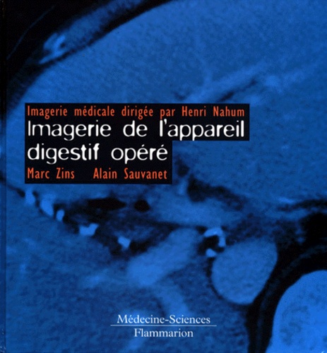Alain Sauvanet et Marc Zins - Imagerie de l'appareil digestif opéré.