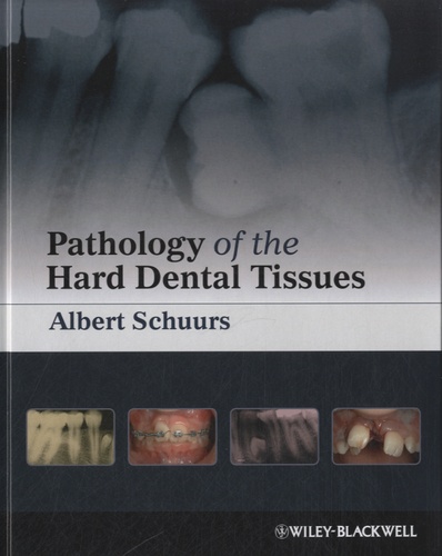 Albert Schuurs - Pathology of the Hard Dental Tissues.