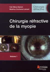 Chirurgie réfractive de la myopie