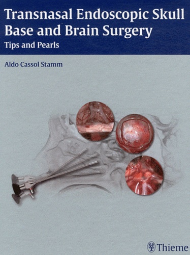 Aldo Cassol Stamm - Transnasal Endoscopic Skull Base and Brain Surgery - Tips and Pearl.