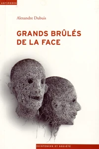Grands brûlés de la face