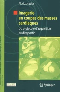 Imagerie en coupes des masses cardiaques