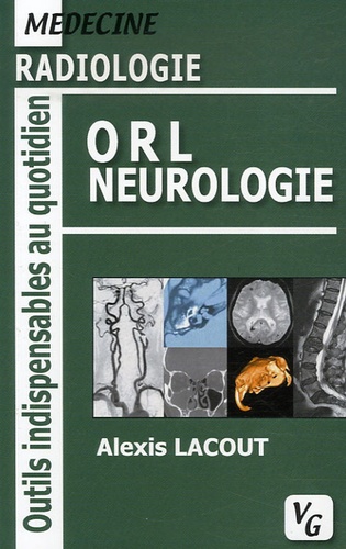 Alexis Lacout - ORL Neurologie - Radiologie.