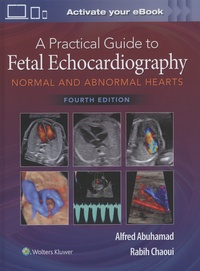 Alfred Abuhamad et Rabih Chaoui - A Practical Guide to Fetal Echocardiography - Normal and Abnormal Hearts.