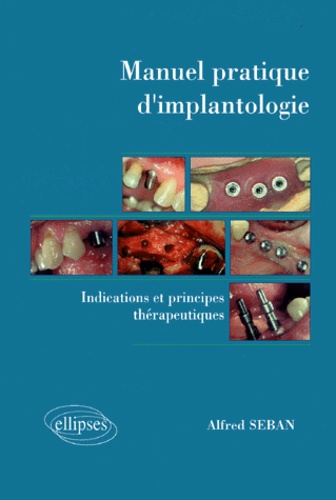 Alfred Seban - Manuel Pratique D'Implantologie. Indications Et Principes Therapeutiques.
