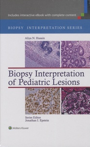 Aliya N. Husain - Biopsy Interpretation of Pediatric Lesions.