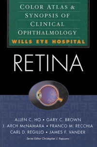 Retina