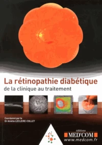 La rétinopathie diabétique