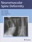 Neuromuscular Spine Deformity