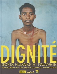 Amnesty International - Dignité - Droits humains et pauvreté, Un document de l'oeil public et d'Amnesty International.