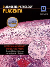 Diagnostic Pathology: Placenta