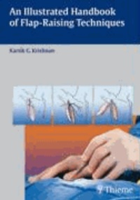 An Illustrated Handbook of Flap-Raising Techniques.