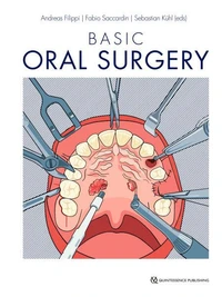 Basic Oral Surgery