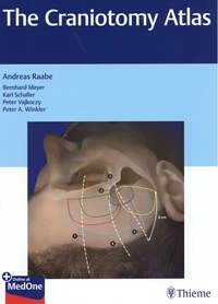 The Craniotomy Atlas