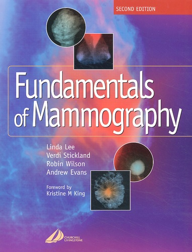 Andrew Evans et Robin Wilson - Fundamentals Of Mammography. 2nd Edition.