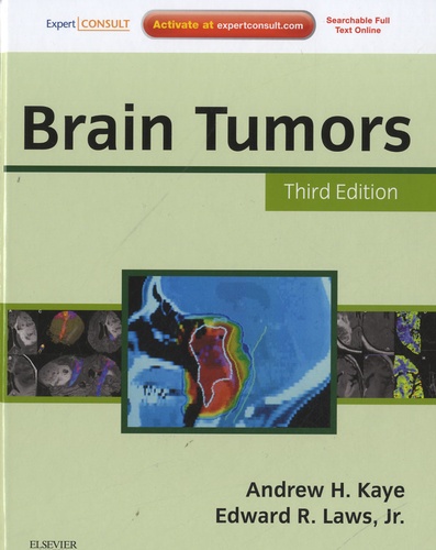 Andrew H. Kaye et Edward R. Laws - Brain Tumors.