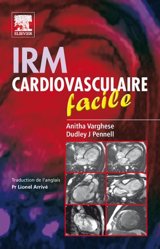 Anita Varghese et Dudley J. Pennell - IRM cardiovasculaire facile.