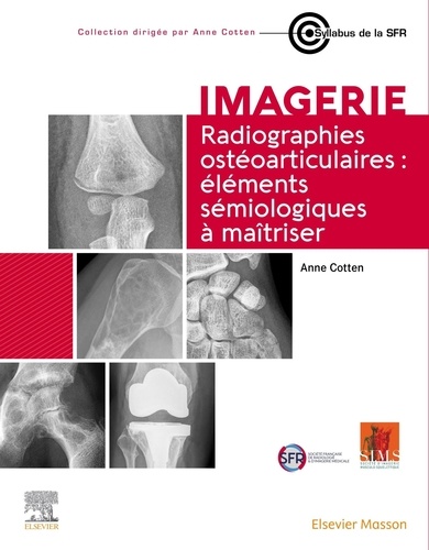 Radiographies ostéoarticulaires. Eléments sémiologiques à maitriser