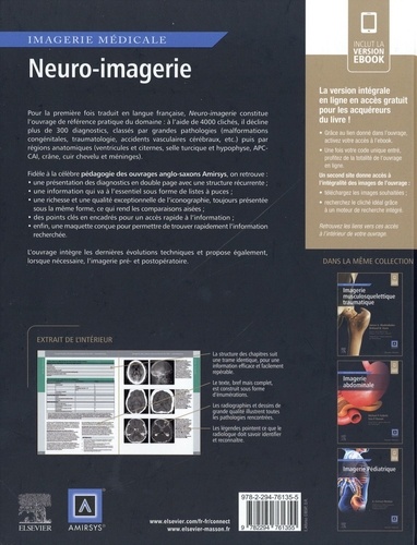 Neuro-imagerie