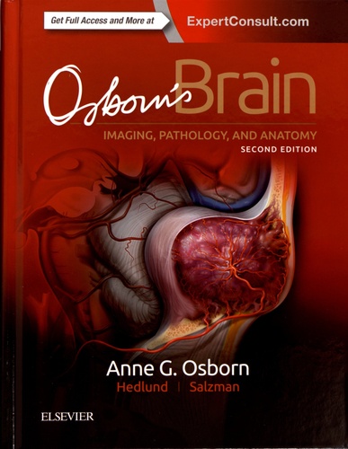 Osborn's Brain. Imaging, pathology, and anatomy 2nd edition