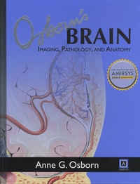 Anne G. Osborn - Osborn's Brain - Imaging, Pathology, and Anatomy.