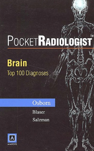 Anne G. Osborn - PocketRadiologist Brain. - Top 100 Diagnoses.